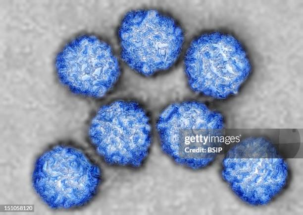 Coxsackie Virus