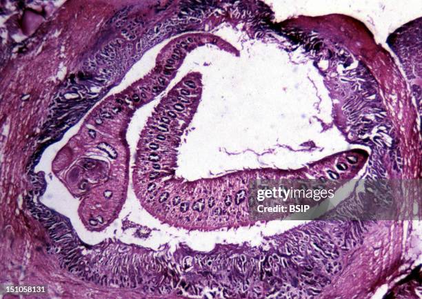 Two Flukes Fasciola Hepatica. Flukes Are Parasitic, Hermaphriditic Flatworms, And Are The Causative Agent Of Distomatosis. Microscopic Image 200X,...