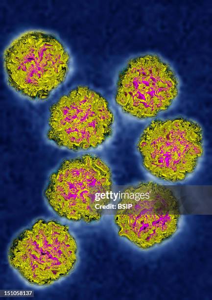 Coxsackie Virus