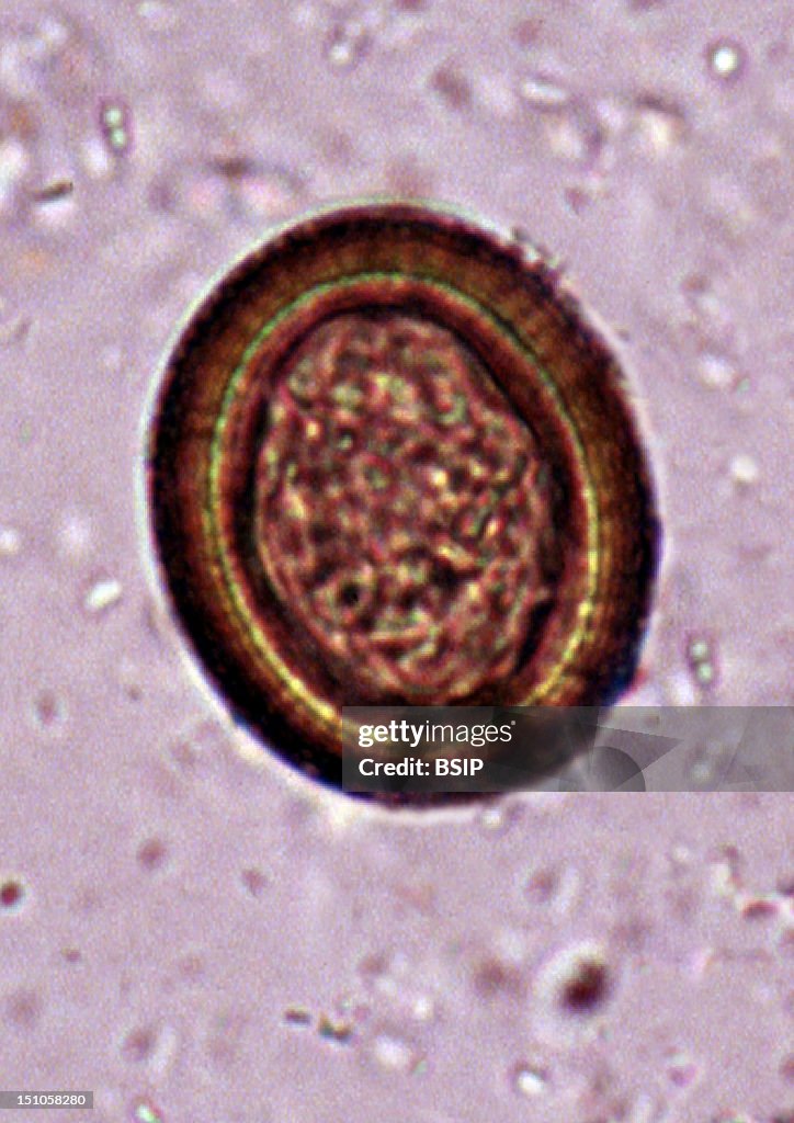 Tenia Insect Egg Of The Taenia Worm, A Parasitic Intestinal Cestode Which Is The ...