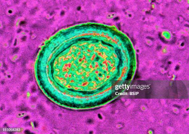 Egg Of The Taenia Worm, A Parasitic Intestinal Cestode Which Is The Causative Agent Of Taeniasis. Microscopic Image 400X.