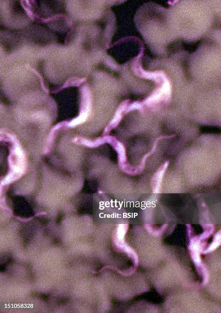 Trypanosoma, A Blood Parasite And The Causative Agent Of Sleeping Sickness Trypanosomiasis Transmitted By The Tse Tse Fly. Microscopic Image 1000X.