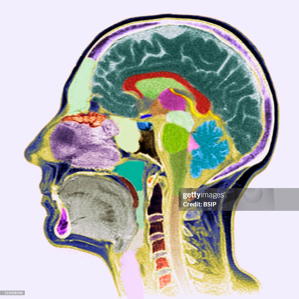 Head, Mri