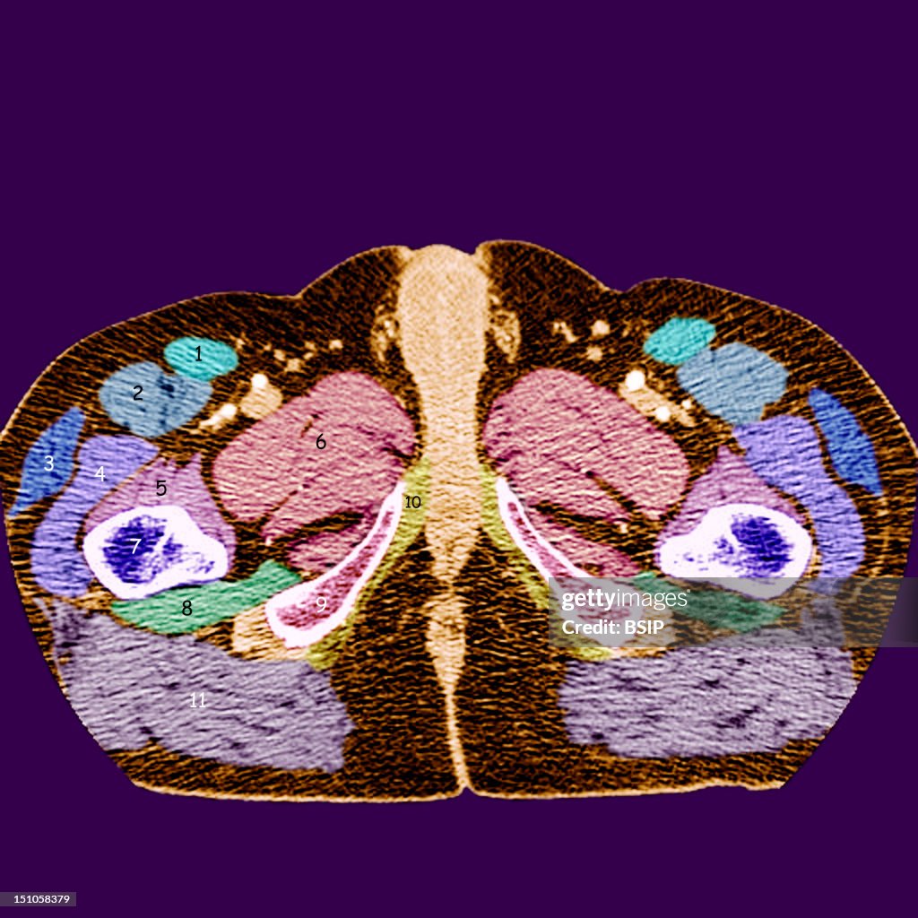 Male Perineum, Scan