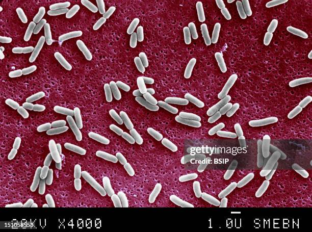 Escherichia Coli Is A Normal Host Of The Human Alimentary Tract. It Is A Potential Pathogen And Can Infect Other Organs Of The Body. This Rod Shaped...