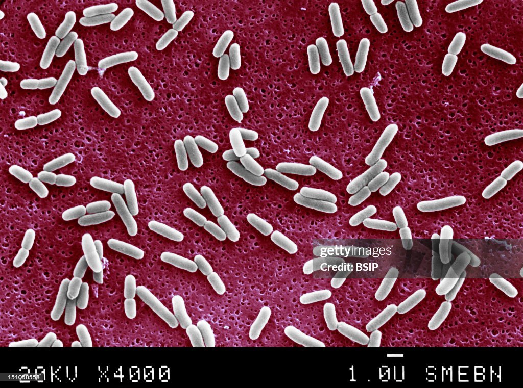 Escherichia Coli, Sem