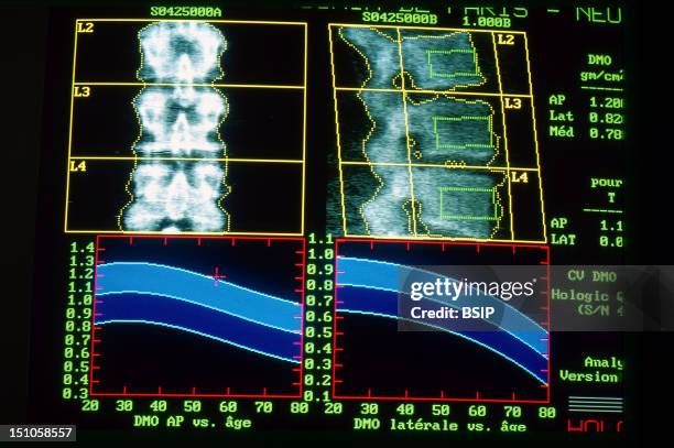 Dexa Scan Photos and Premium High Res Pictures - Getty Images