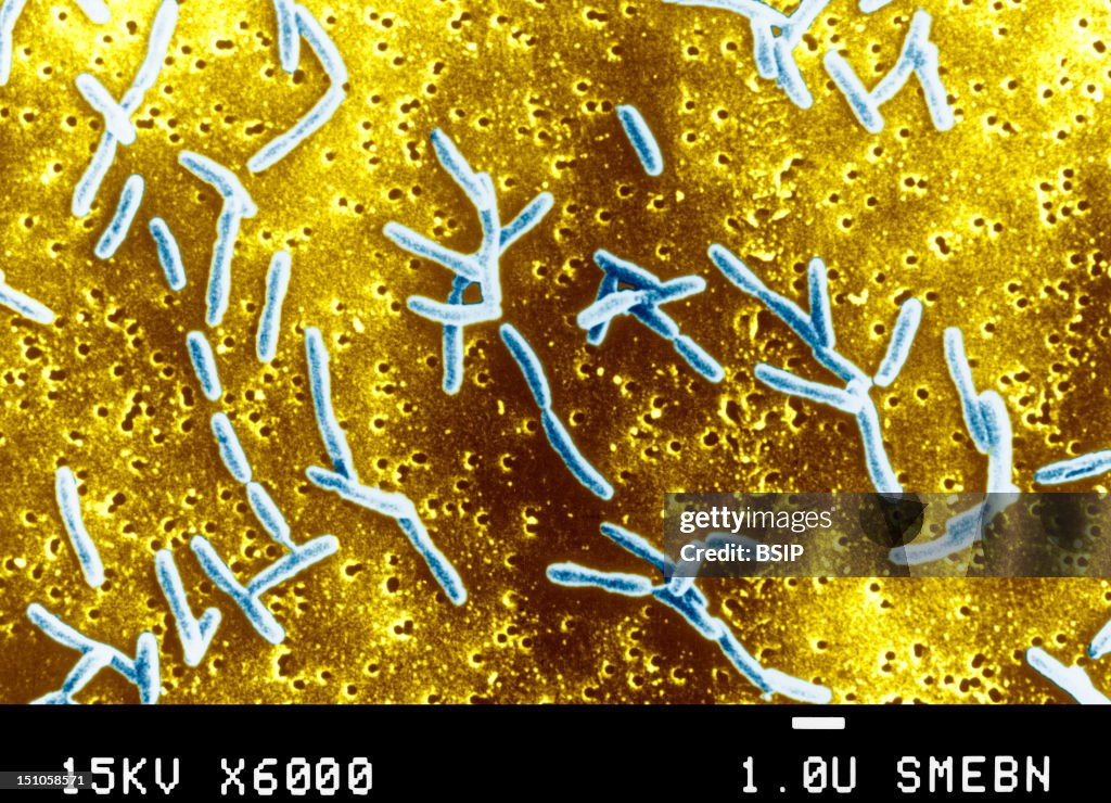 Campylobacter Jejuni