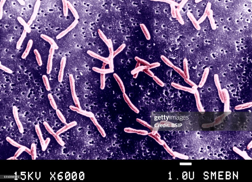 Campylobacter Jejuni