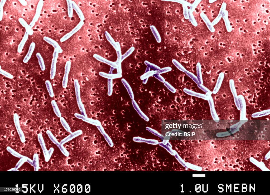 Campylobacter Jejuni