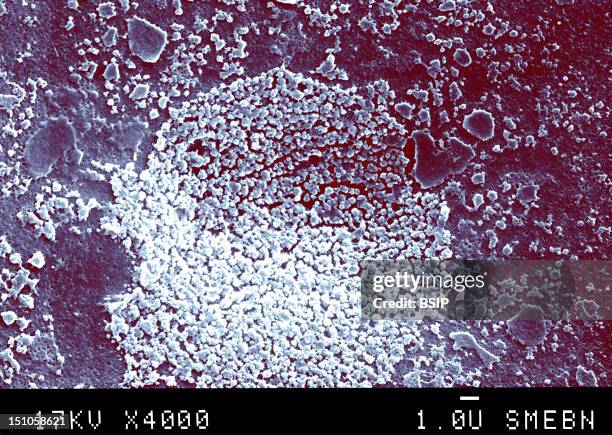 Mycoplasmas Are Miniscule Bacteria Lacking A Cell Wall. Found In Nature, In Humans, And In Animals, Mycoplasmas Are The Smallest Known Organisms...