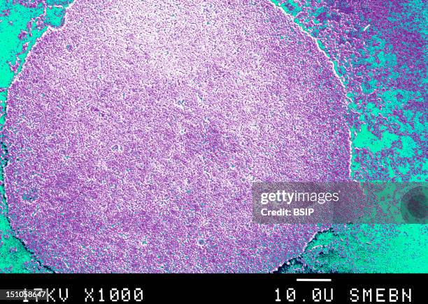 Mycoplasmas Are Miniscule Bacteria Lacking A Cell Wall. Found In Nature, In Humans, And In Animals, Mycoplasmas Are The Smallest Known Organisms...