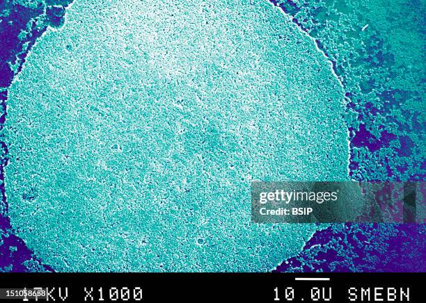 Mycoplasmas Are Miniscule Bacteria Lacking A Cell Wall. Found In Nature, In Humans, And In Animals, Mycoplasmas Are The Smallest Known Organisms...