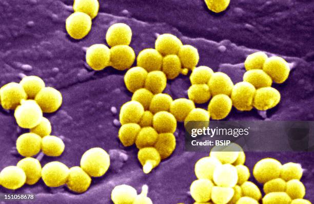 Staphylococcus Aureus Is A Widespread Bacteria Commonly Found On The Skin Of Nearly Half Of The Healthy Population. They Are Potential Pathogens And...