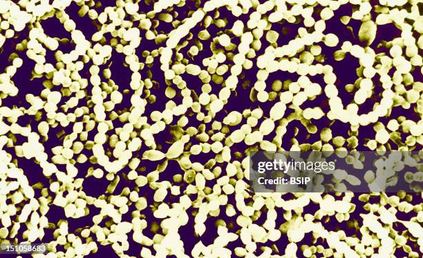 Streptococci Are Potentially Pathogenic Gram Positive Micro Organisms Growing In Pairs Or Chains. They Occur As Normal Hosts In Man. Streptococci Are...