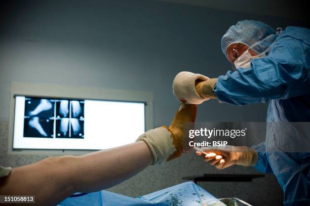 Photo Essay At Alleray Labrouste Clinic, Paris, France. Surgery Of A Hallux Valgus. Disinfection Of The Foot With Betadine Before The Intervention.