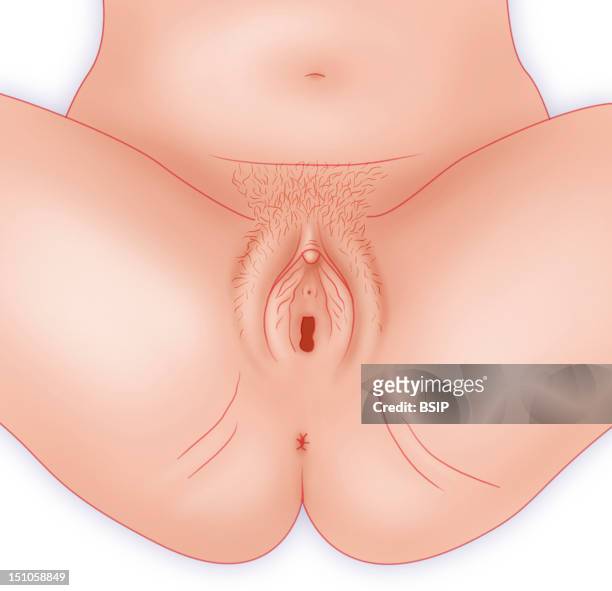 Representation Of The Anatomy Of The Female Genital Organs Gynecological View. The External Genital Apparatus Comprise The Pubis, The Labia Majora...