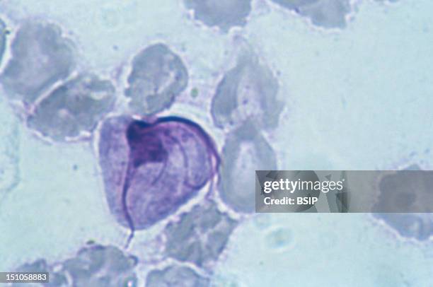 Trichomonas Vaginalis