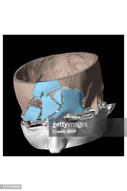 Skull Scan 4,677 3d Skull Stock Photos, High-Res Pictures, and Images - Getty Images