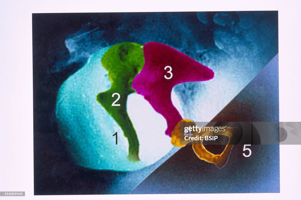Middle Ear, Drawing