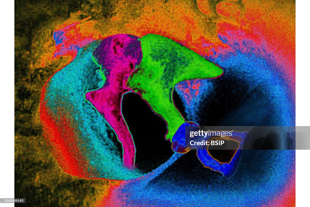 Middle Ear, Drawing