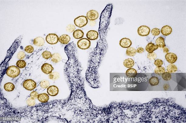 Transmission Electron Micrograph Of The Sin Nombre Hanta Virus. Hantaviruses That Cause Hantavirus Pulmonary Syndrome Hps Are Carried In Rodent...