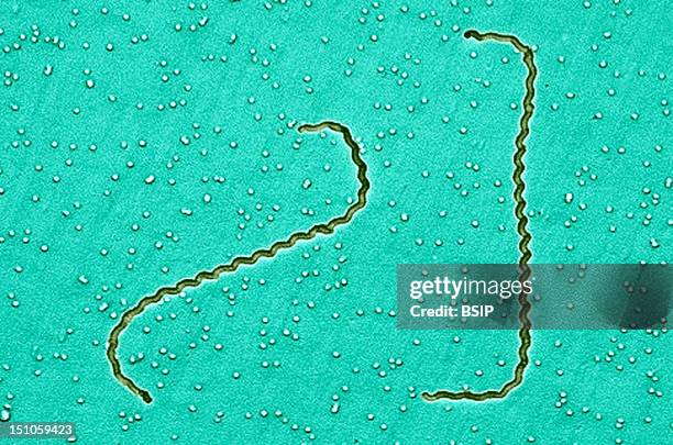 Scanning Electron Micrograph Of Leptospira Interrogans Strain Rga. Two Spirochetes Bound To A 0. 2 ?m Filter. Strain Rga Was Isolated In 1915 By...