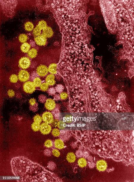 Electron Photomicrograph Of The Machupo Virus. Machupo Virus Is A Member Of The Arenavirus Family, Isolated In The Beni Province Of Bolivia In 1963;...