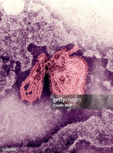 Electron Micrograph Of The Mumps Virus. The Mumps Virus Is A Member Of The Family Of Paramyxoviridae, And Is Enveloped By A Helical Ribonucleic...