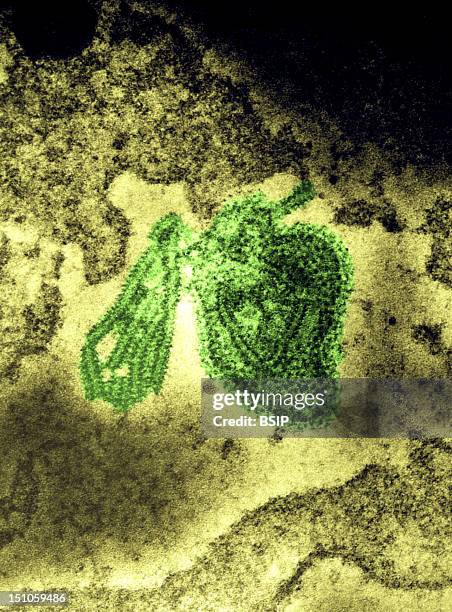 Electron Micrograph Of The Mumps Virus. The Mumps Virus Is A Member Of The Family Of Paramyxoviridae, And Is Enveloped By A Helical Ribonucleic...
