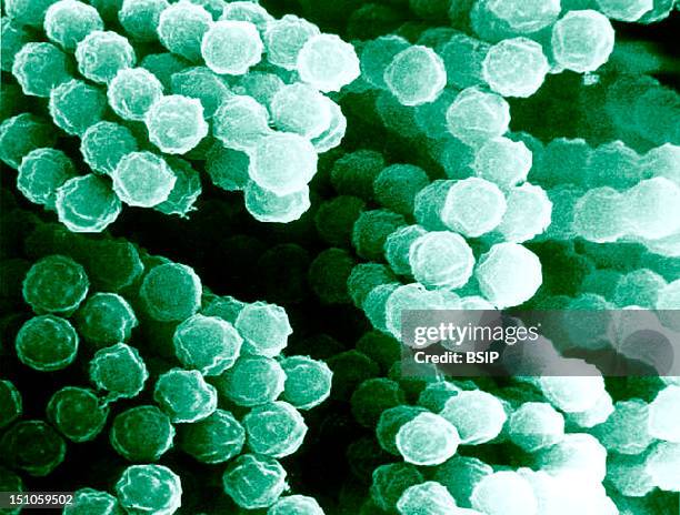 Scanning Electron Micrograph Of Aspergillus Species. Aspergillus Is A Group Of Molds Known To Produce Aflatoxins A Known Carcinogen That Can Infect...