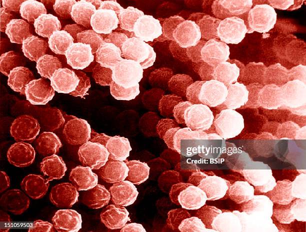 Scanning Electron Micrograph Of Aspergillus Species. Aspergillus Is A Group Of Molds Known To Produce Aflatoxins A Known Carcinogen That Can Infect...