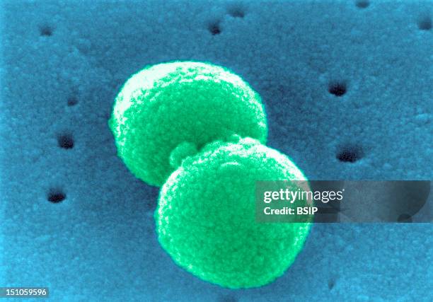 Scanning Electron Micrograph Of Streptococcus Pneumoniae.