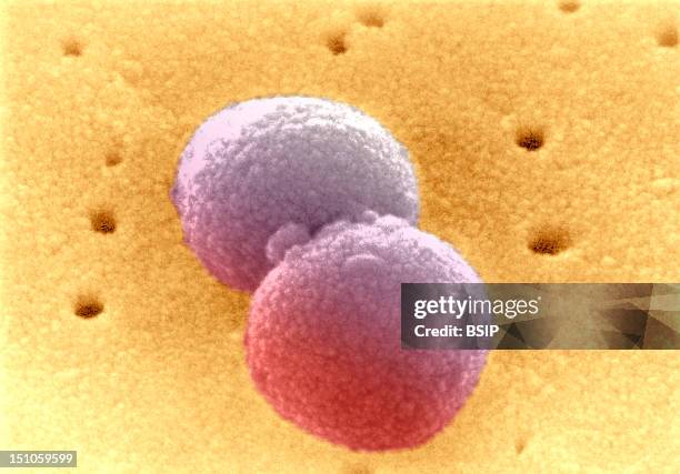 Diplococcus Microscope 118 Diplococcus Stock Photos, High-Res Pictures, and Images - Getty Images