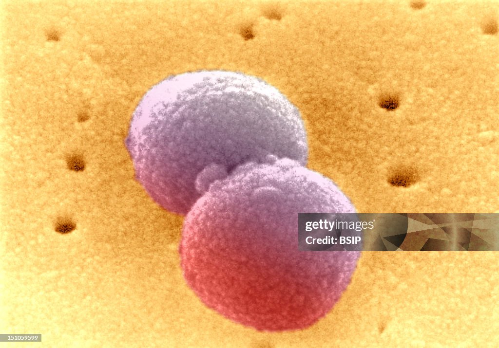 Pneumococcus