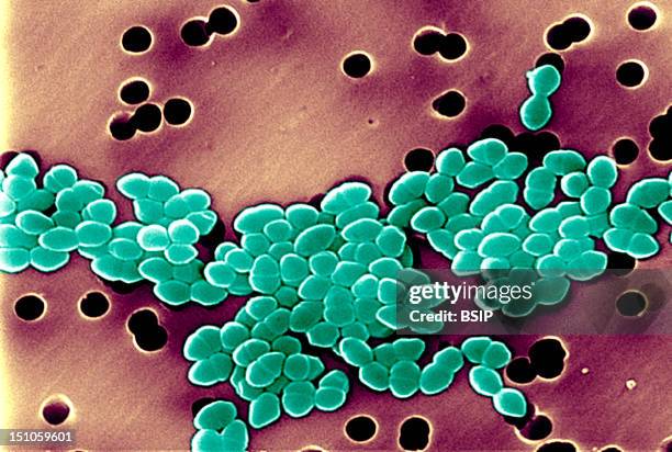 Vancomycin Resistant Enterococci Vre. Scanning Electron Micrograph Of Vancomycin Resistant Enterococci Vre. Illness Due To Vre Infections In Healthy...
