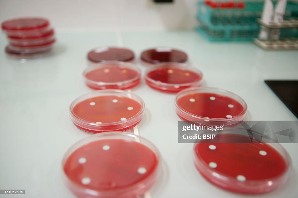 Antimicrob. Susceptibility Test
