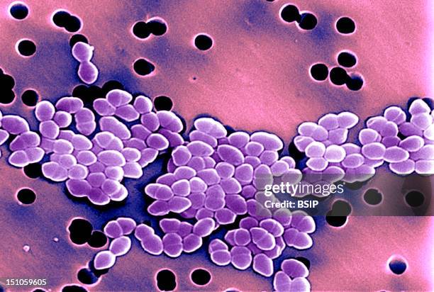 Vancomycin Resistant Enterococci Vre. Scanning Electron Micrograph Of Vancomycin Resistant Enterococci Vre. Illness Due To Vre Infections In Healthy...