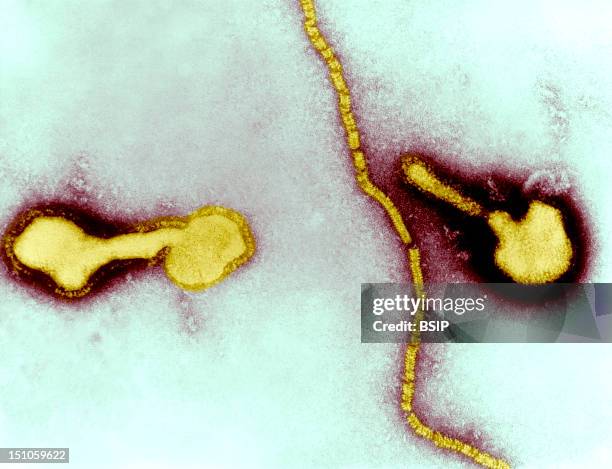Transmission Electron Micrograph Of Parainfluenza Virus. Two Intact Particles And Free Filamentous Nucleocapsid.