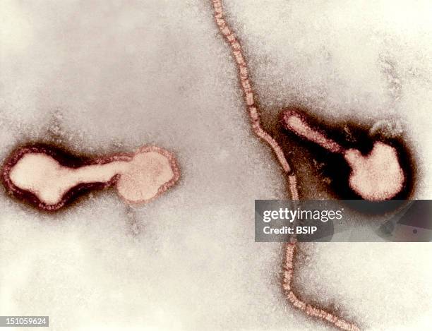 Transmission Electron Micrograph Of Parainfluenza Virus. Two Intact Particles And Free Filamentous Nucleocapsid.
