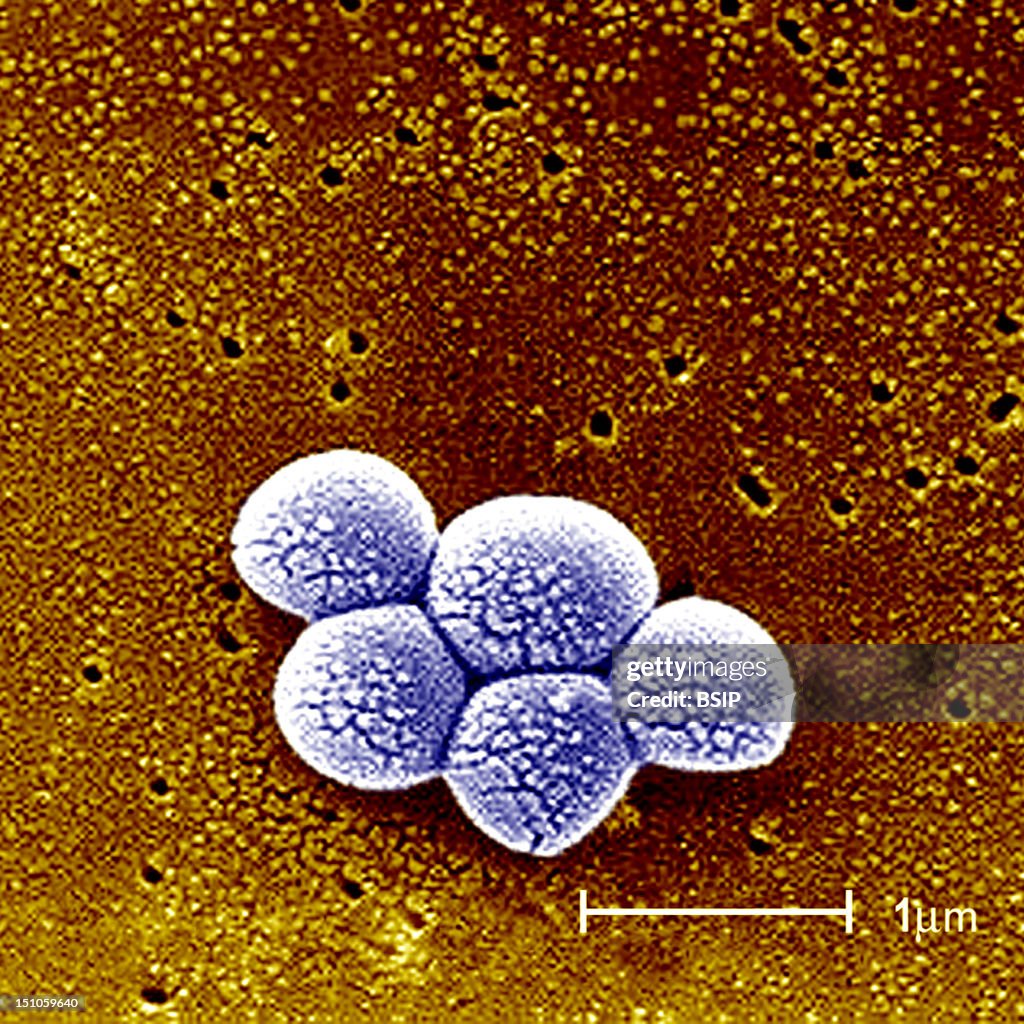 Staphylococcus Aureus Sem