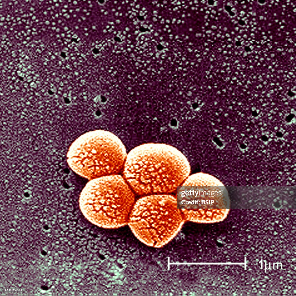 Staphylococcus Aureus Sem