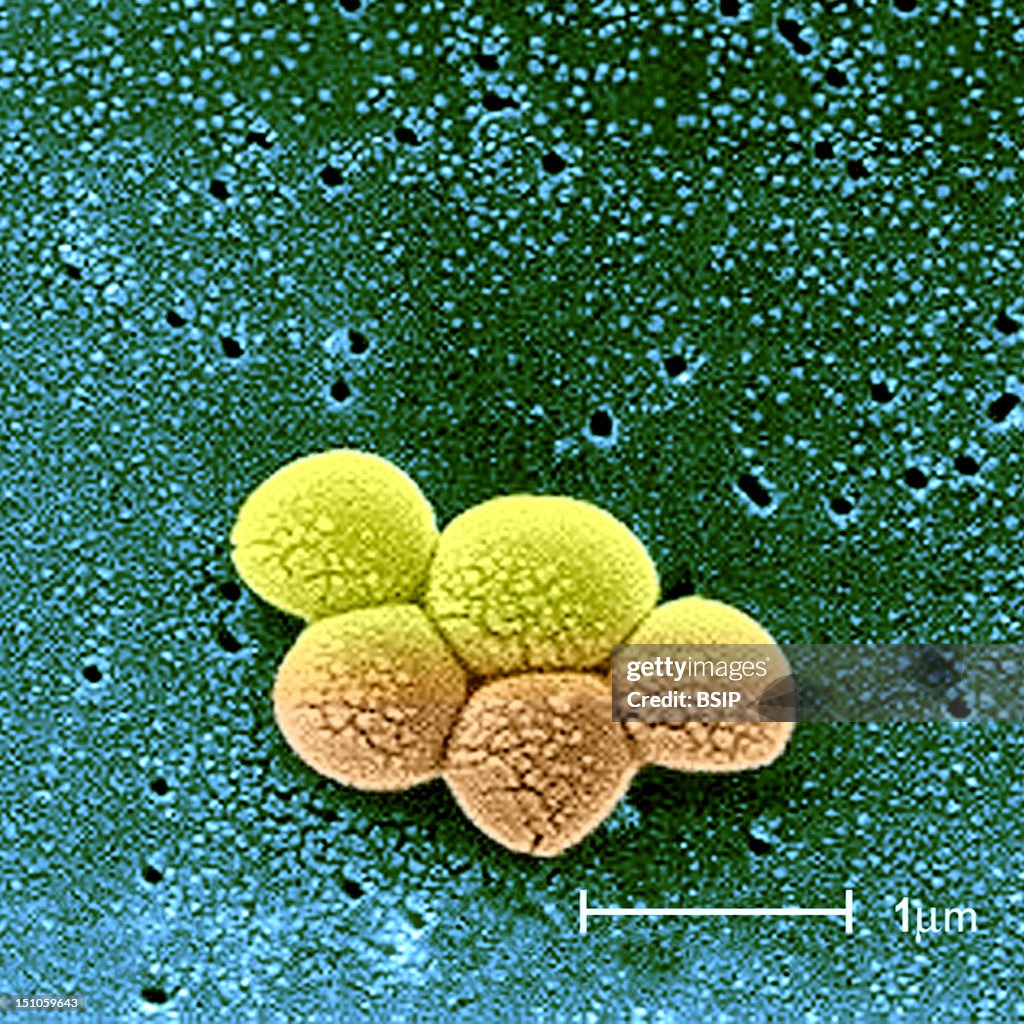 Staphylococcus Aureus Sem