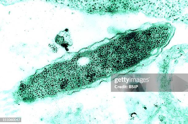 Legionella Pneumophila Colorized Tem, Approximately X 129 500, Cultured In An Embryonated HenS Egg. Legionella Pneumophila Is A Gram Negative...