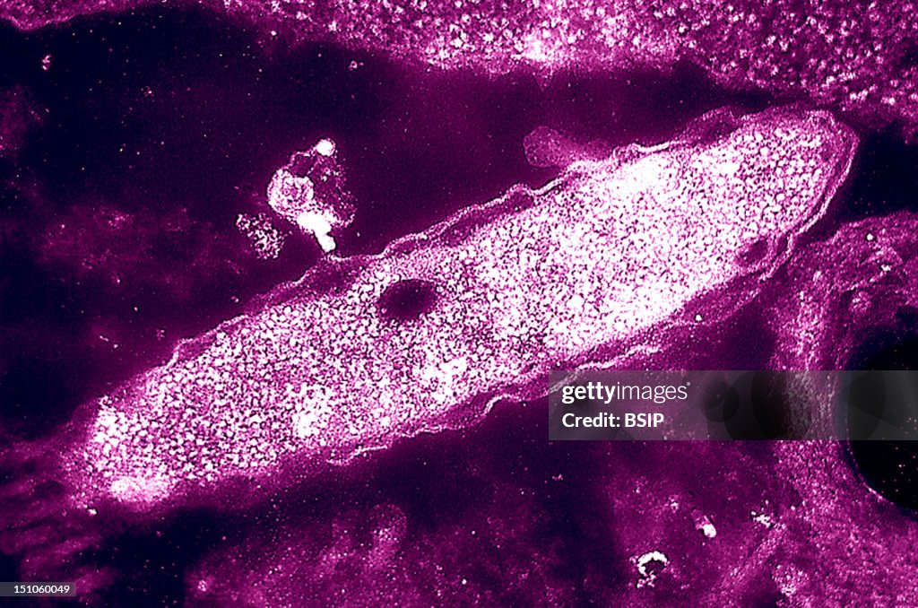 Legionella Pneumophila