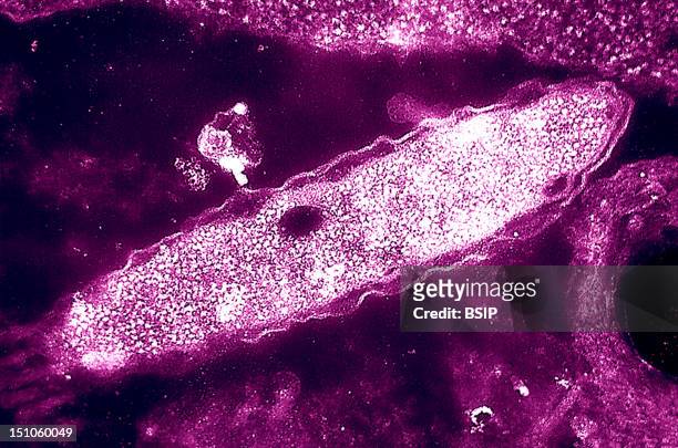 Legionella Pneumophila Colorized Tem, Approximately X 129 500, Cultured In An Embryonated HenS Egg. Legionella Pneumophila Is A Gram Negative...