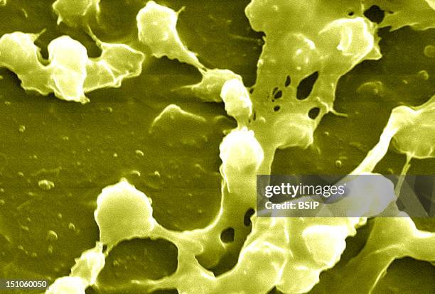 Staphylococcus Aureus In Biofilm, Coming From The Inside Of A Permanent Urinary Catheter Colorized Sem, X 2 363. A Biofilm Is A Group Of Micro...