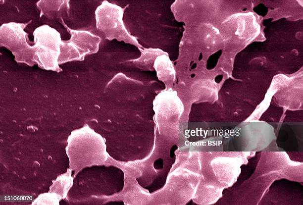 Staphylococcus Aureus In Biofilm, Coming From The Inside Of A Permanent Urinary Catheter Colorized Sem, X 2 363. A Biofilm Is A Group Of Micro...