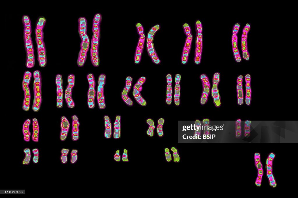 Female Caryotype