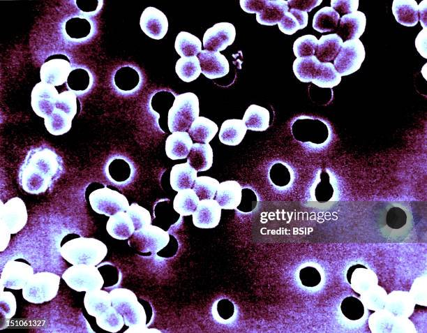 Enterococci Colorized Sem. Enterococci Genus Enterococcus Are Gram Positive Bacteria, Under The Shape Of Cocci Or Cocobacilli, Facultative Anaerobes....